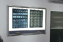 A large medical image displayed on a wall, showcasing an X-ray viewer from the Shree Danev Foundation.